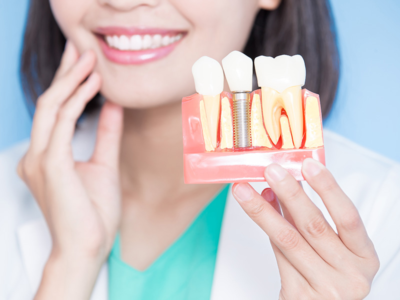 A dental hygienist holding a model of teeth with visible fillings and an implant, showcasing oral health care tools.