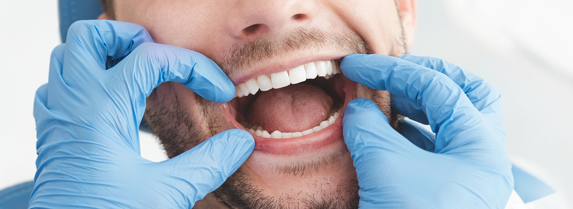 A man with his mouth open, surrounded by dental tools, likely in a dental office setting.